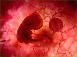 20090607205303-395-aborto.jpg