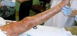 20100501025518-461-picaduramedusa.jpg