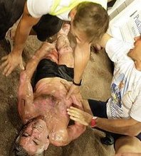 20100810032743-101-colapso.jpg - Un hombre muere en el Mundial de sauna